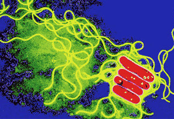 LEGIONNAIRE’S DISEASE’ PREVENTION AND CONTROL